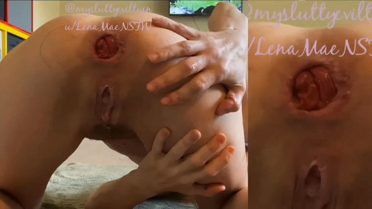 Farts, gaping and prolapse image 9