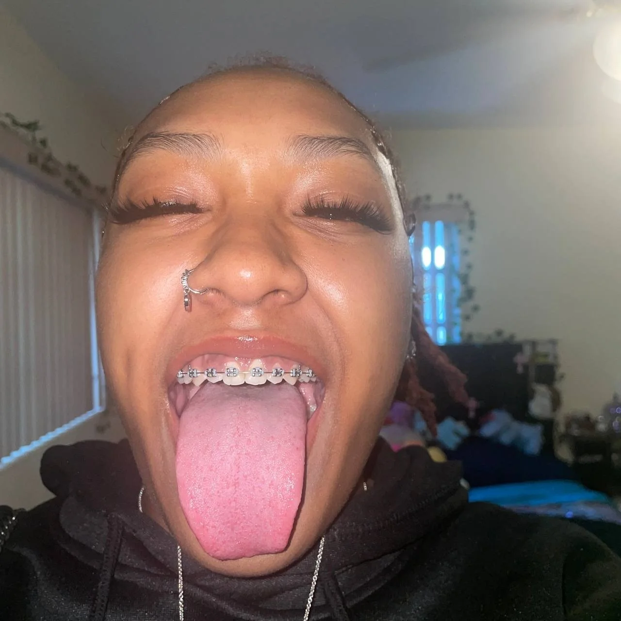BBW Braces image 13