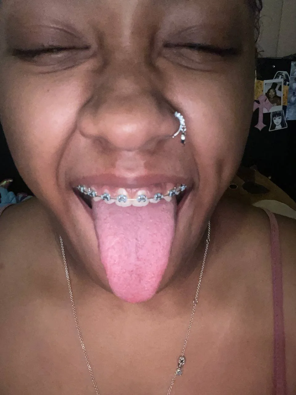 BBW Braces image 17