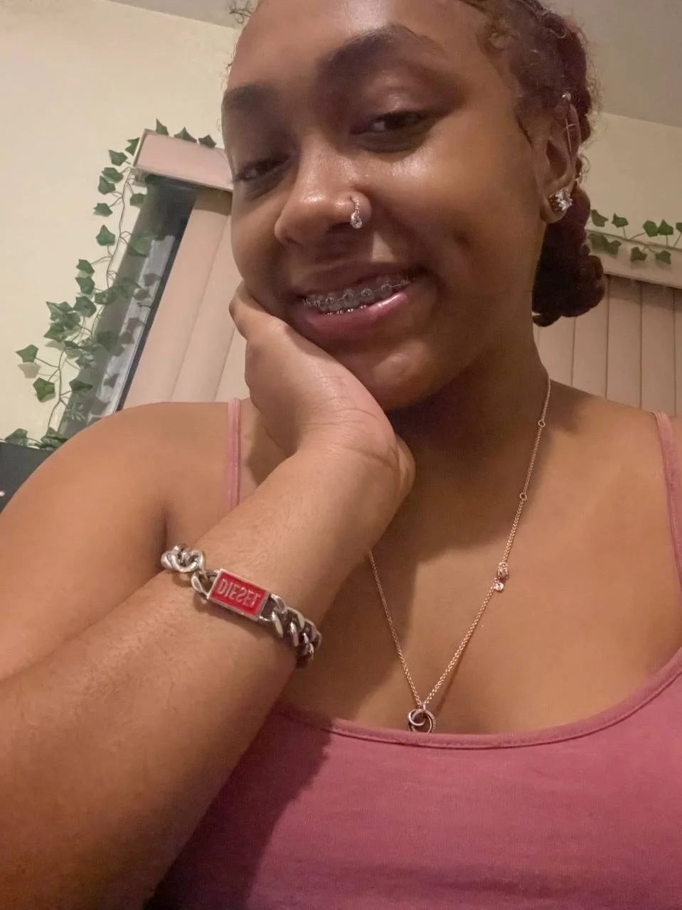 BBW Braces image 23