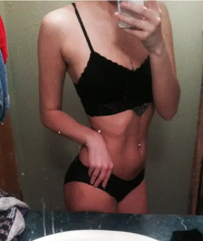 anorexic fuckmeat Allicia cover image