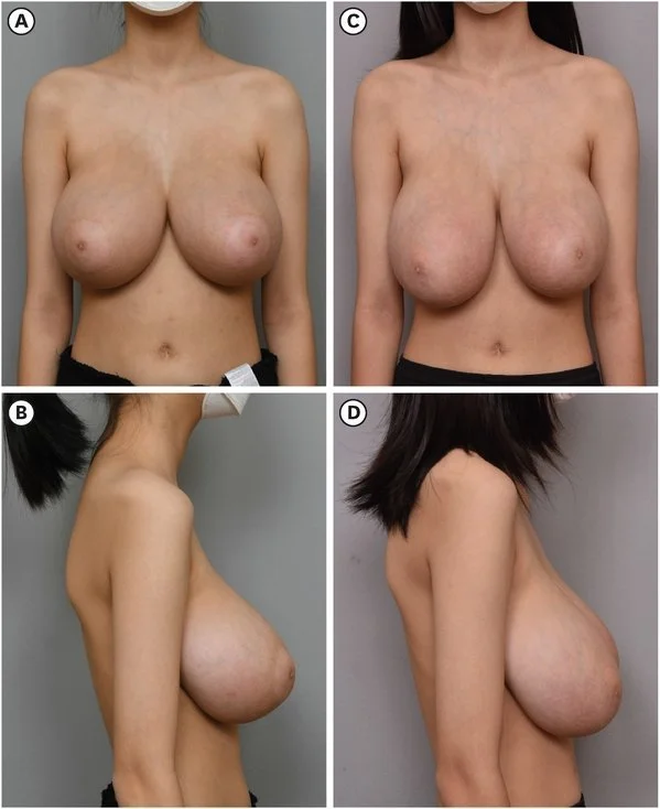 RIP to these awesome tits image 4