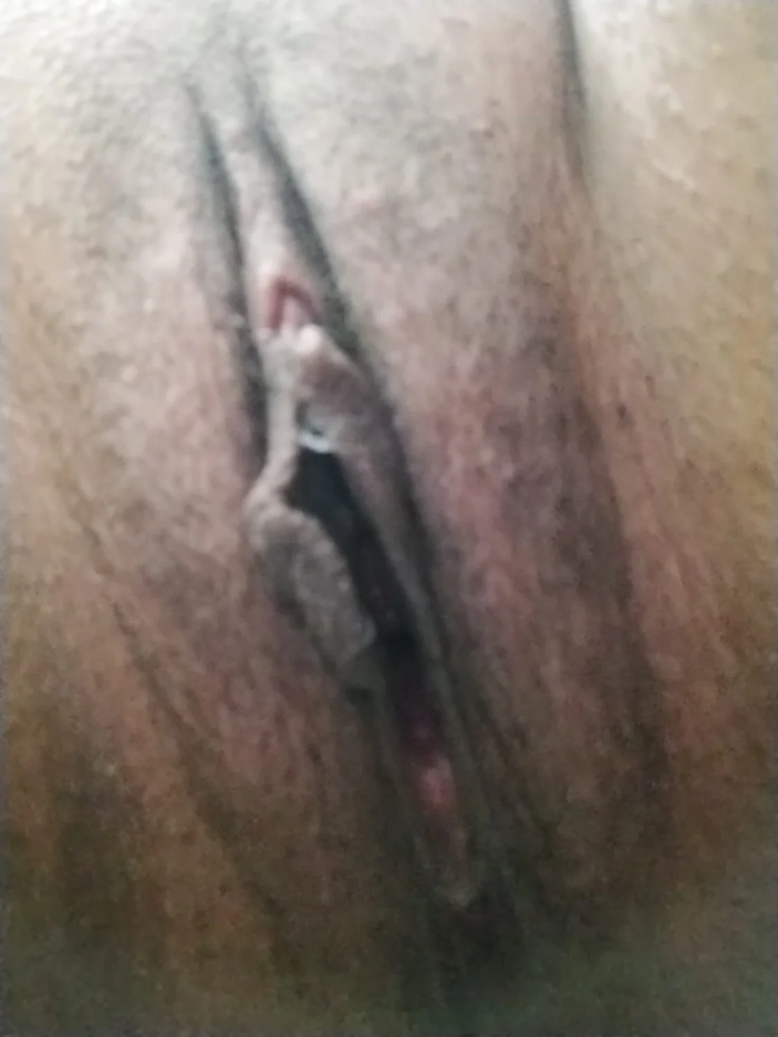 🙈 image 8