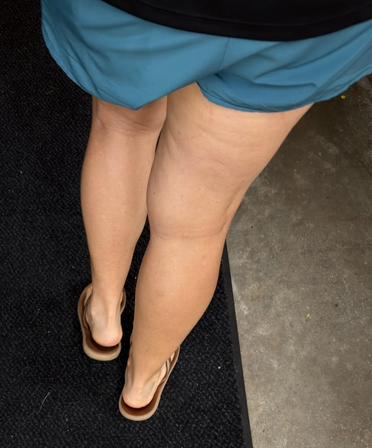 Woman’s feet in sandals image 10