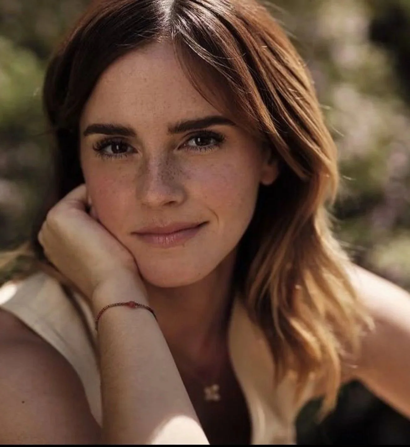 Emmagasms for freckles - Emma Watson seems to be getting more beautiful image 2