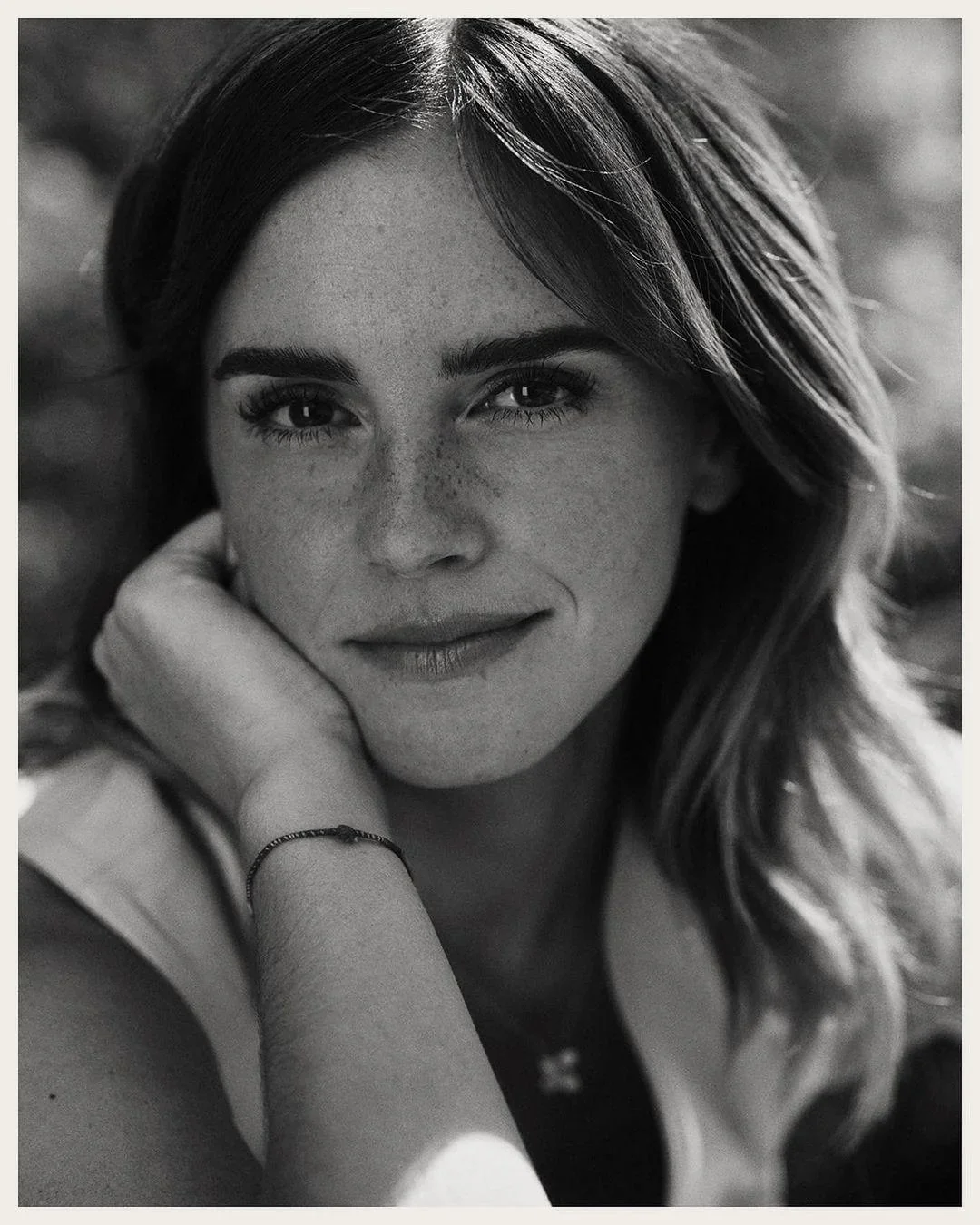 Emmagasms for freckles - Emma Watson seems to be getting more beautiful image 5