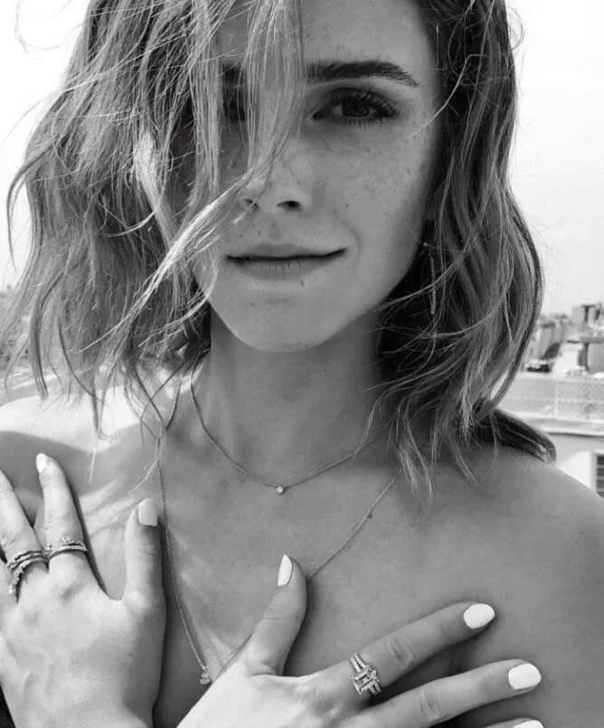 Emmagasms for freckles - Emma Watson seems to be getting more beautiful image 7