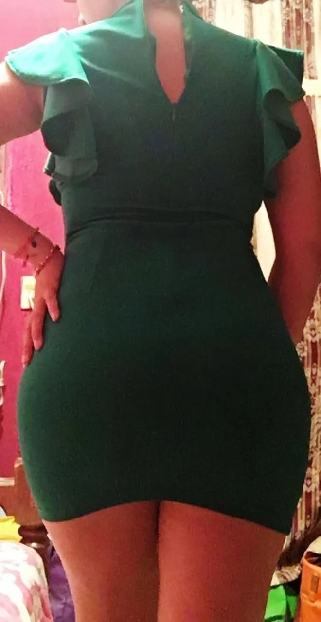 Erika putita de 27 años quemada por su ex image 6