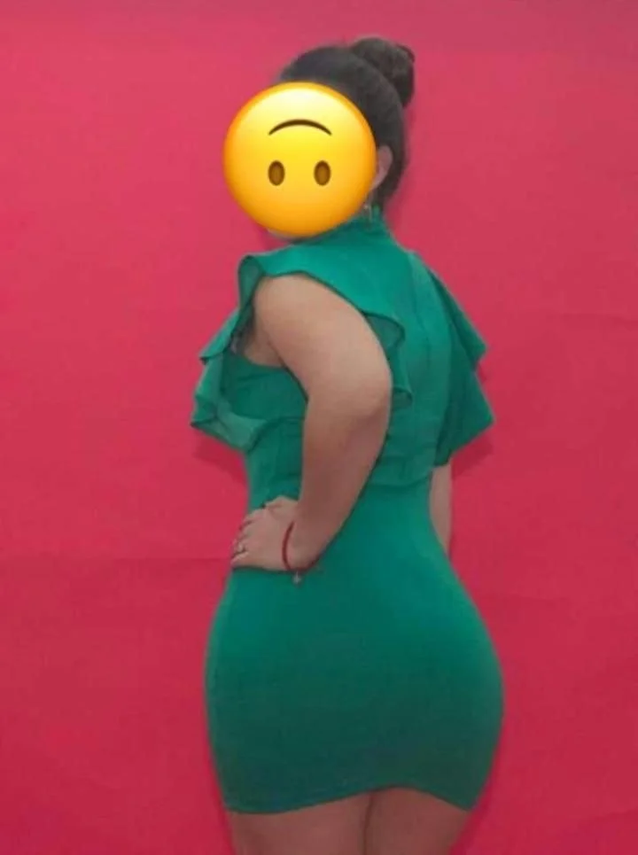 Erika putita de 27 años quemada por su ex image 9