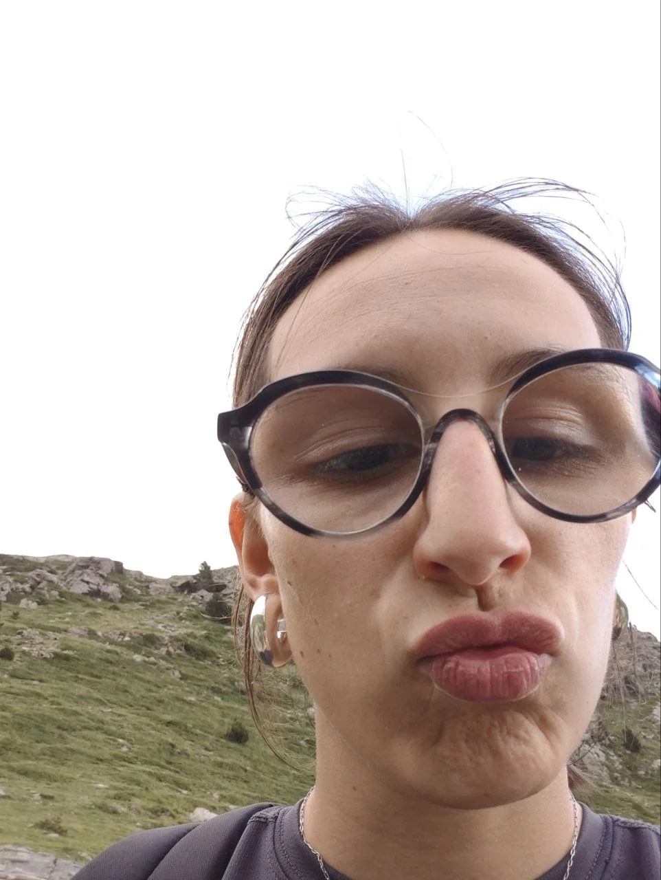 Zorrita con cara de estupida quemada en telegram image 20