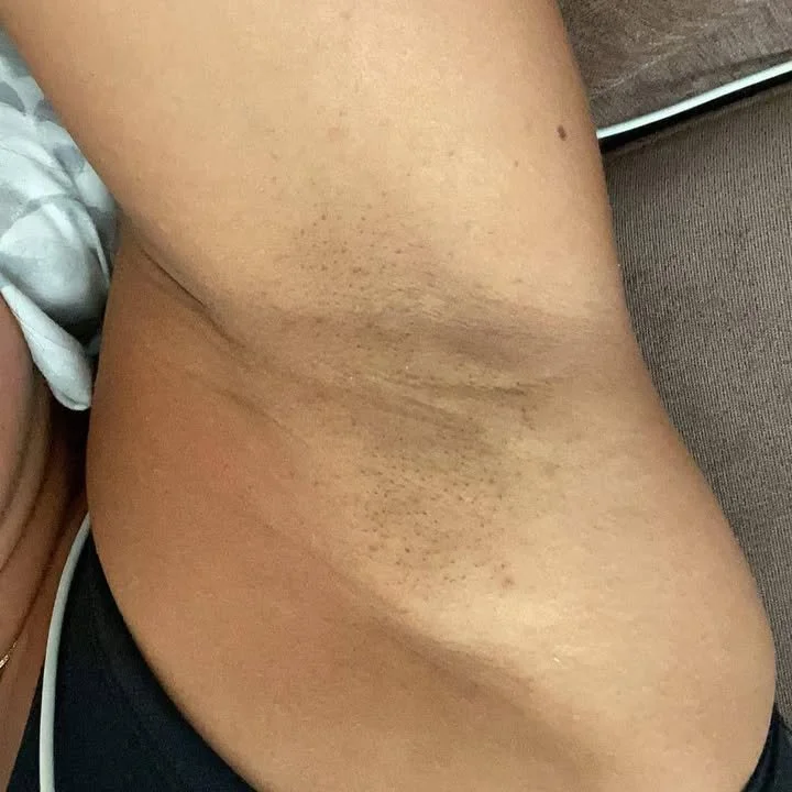 Pra quem curte axilas como eu! image 4