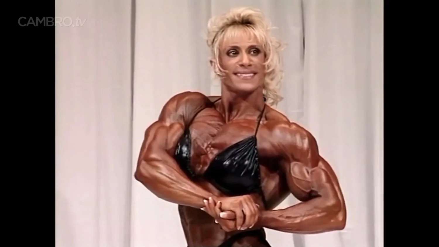 Mrs Chizevsky, spermatic muscular masses on stage image 11