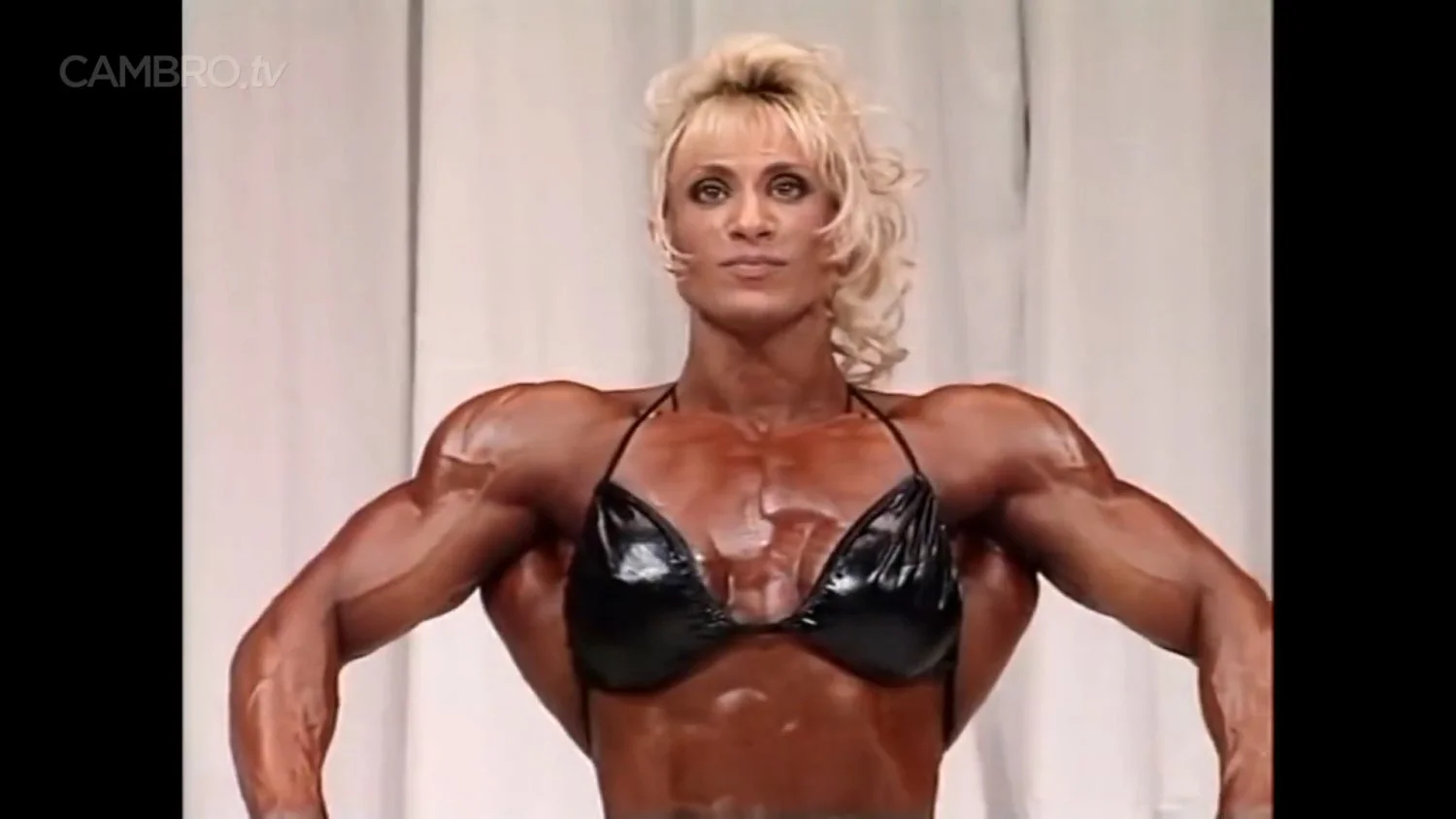 Mrs Chizevsky, spermatic muscular masses on stage image 12