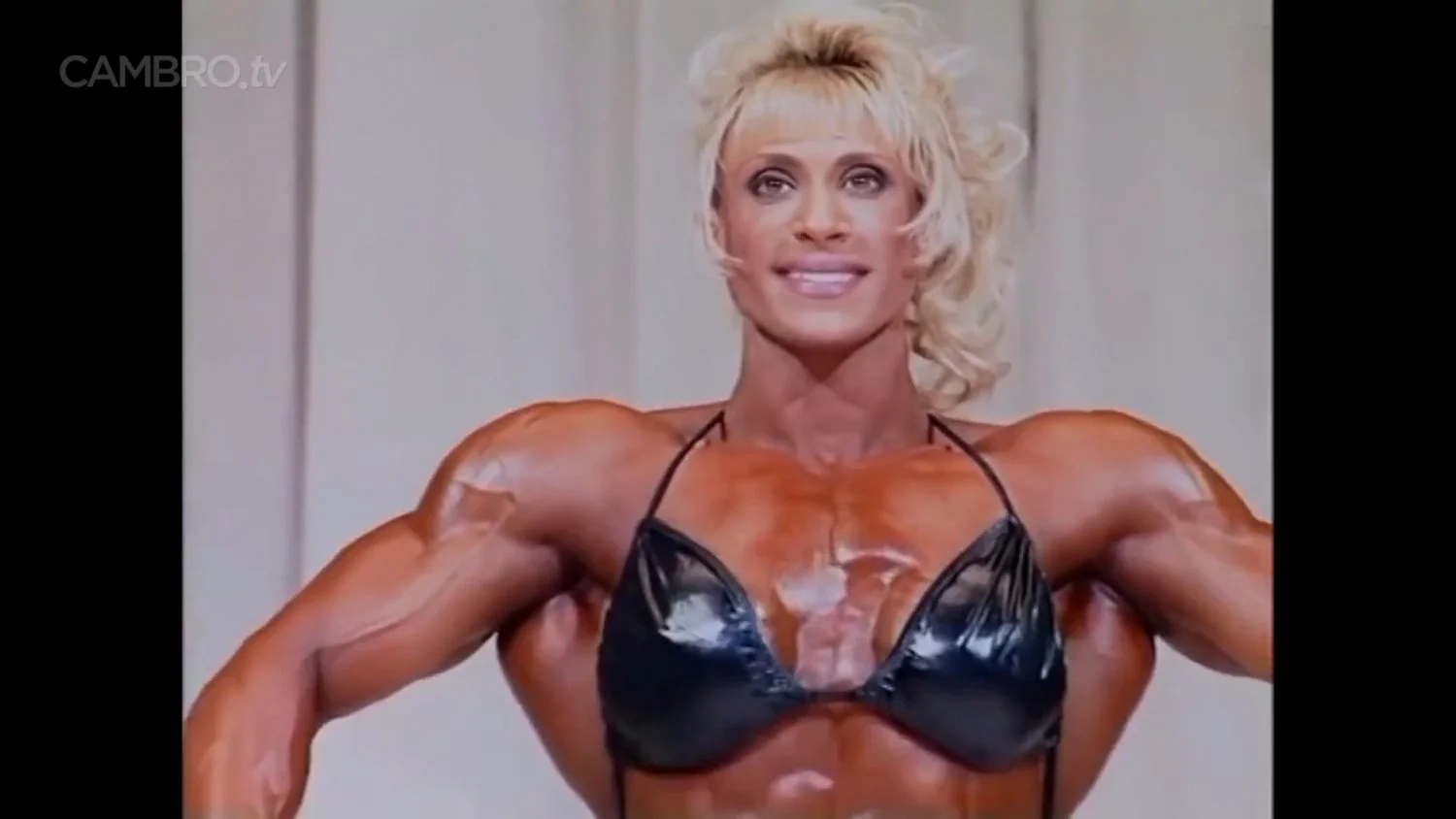 Mrs Chizevsky, spermatic muscular masses on stage image 3