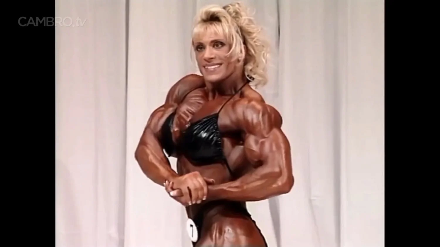 Mrs Chizevsky, spermatic muscular masses on stage image 5