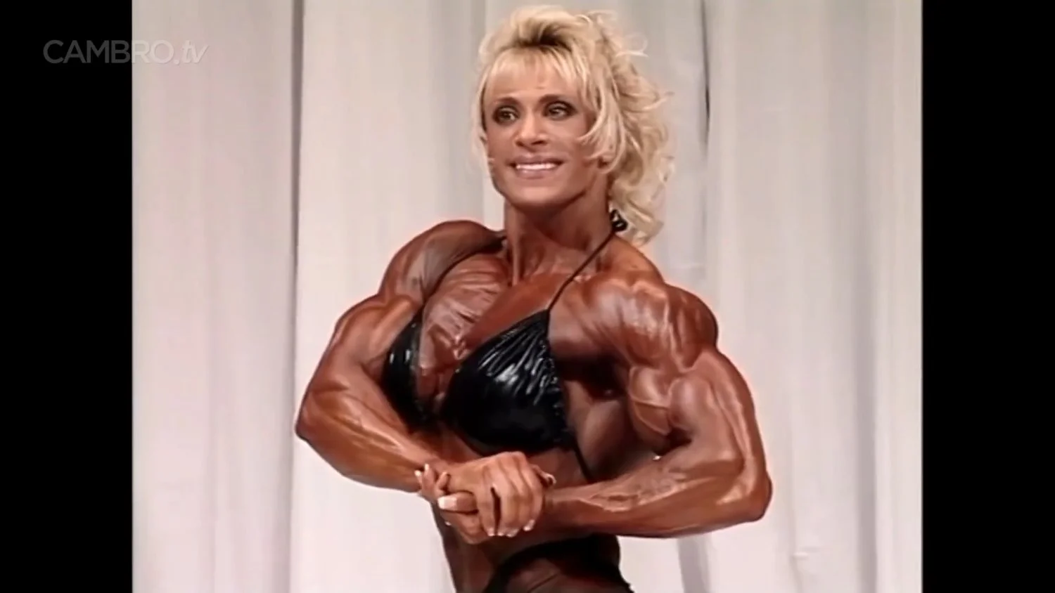 Mrs Chizevsky, spermatic muscular masses on stage image 6