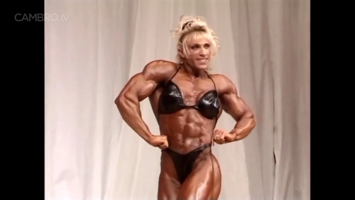 Mrs Chizevsky, spermatic muscular masses on stage image 7