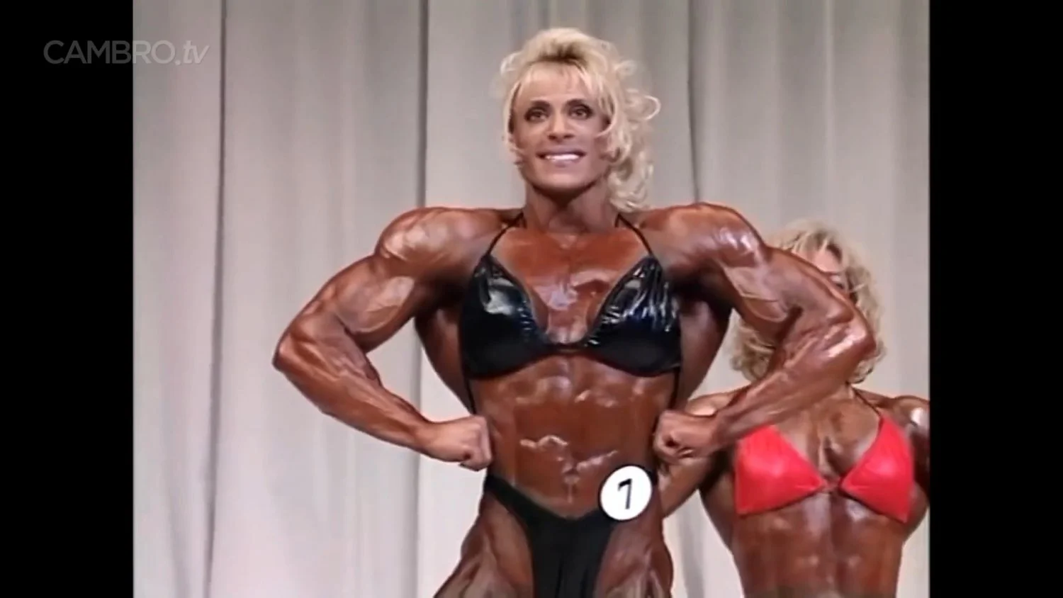 Mrs Chizevsky, spermatic muscular masses on stage image 8