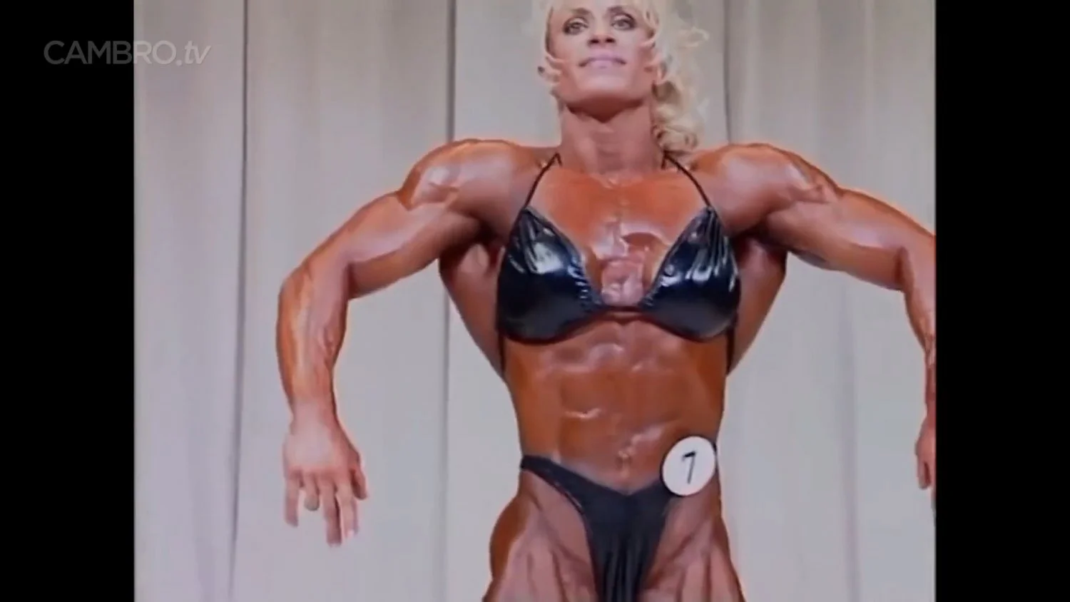 Mrs Chizevsky, spermatic muscular masses on stage image 9