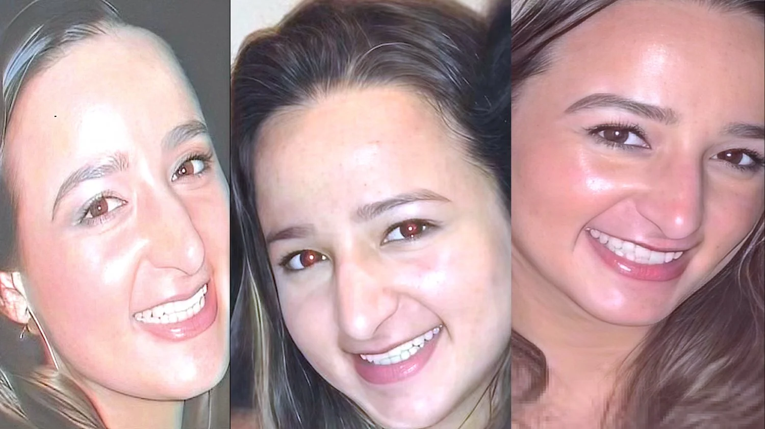 stunning smile main image