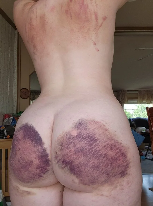 Nerdy & bruised pawg image 6