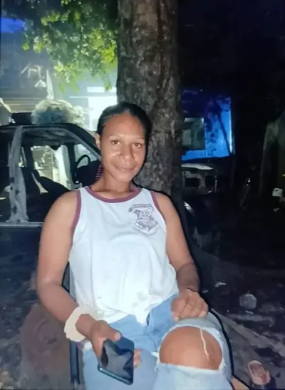 Showing her pussy🇵🇬 cover image