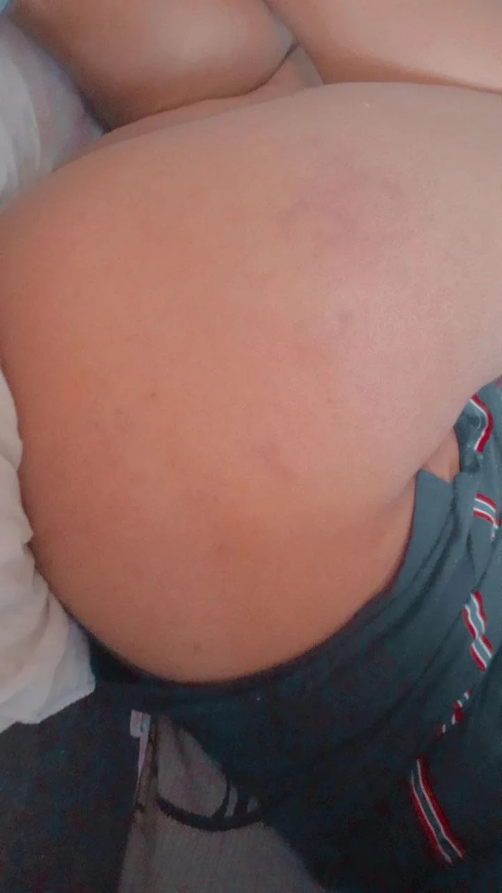 Morena image 2