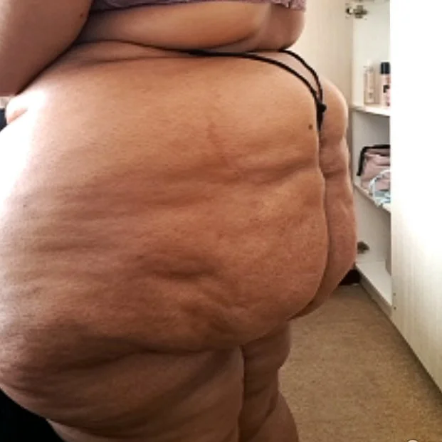Ebony ExtraCellulite Booty & HugeMelons 😨 image 2