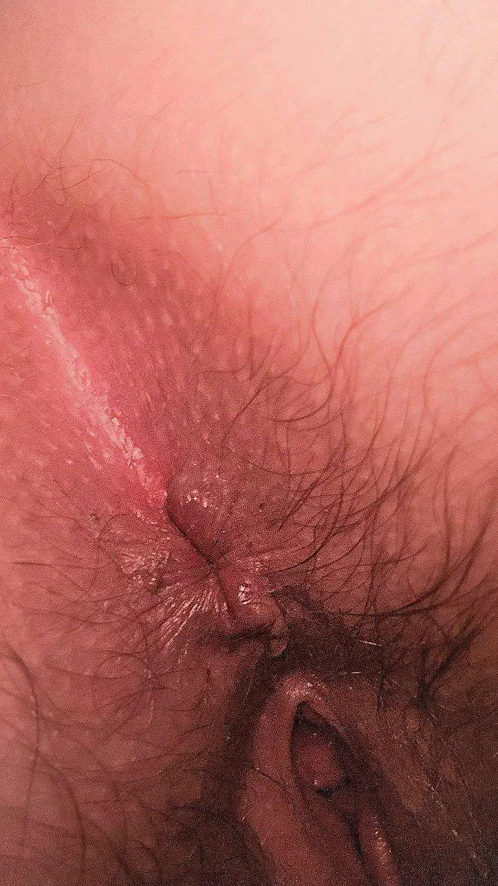 Wife's dirty asshole PLEASE Kik me for more image 9