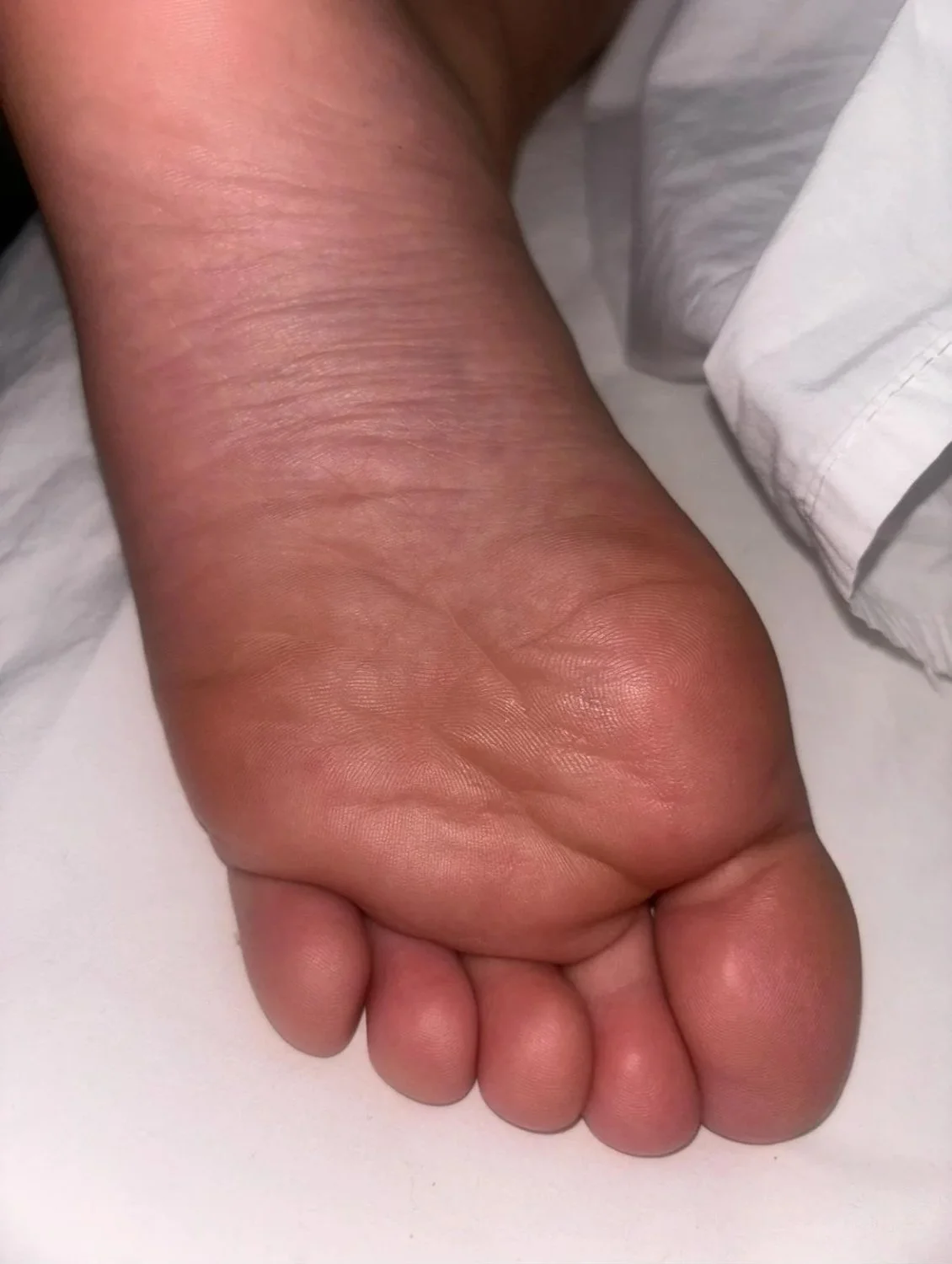 friend's feet after night out image 2
