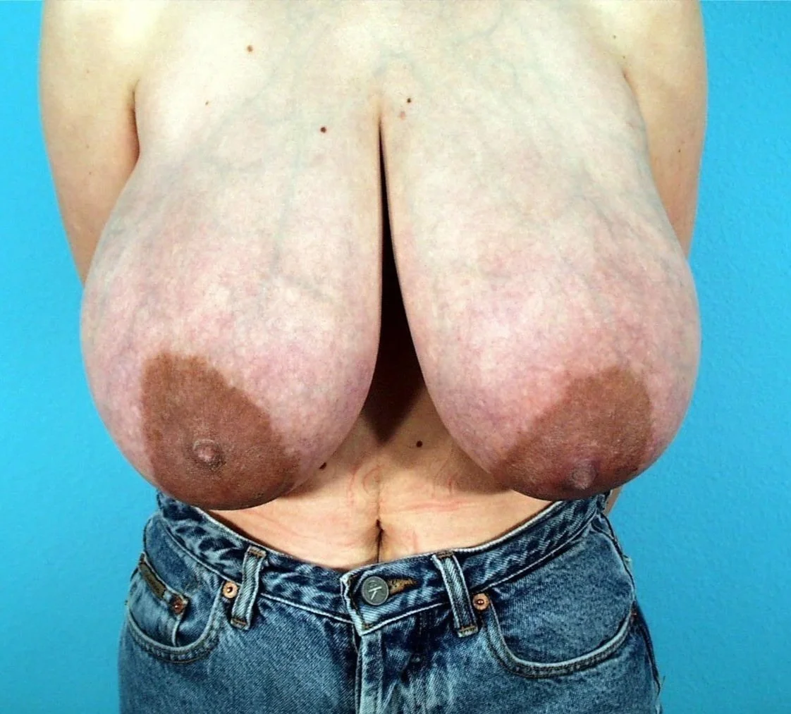 Huge Random Tits Pt 10 image 12