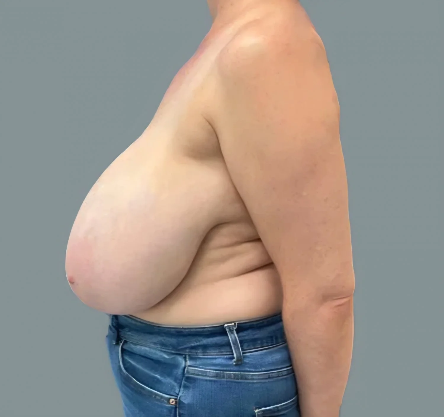 Huge Random Tits Pt 10 image 15