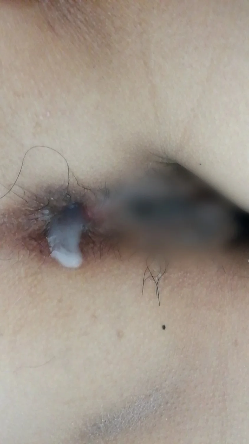 japanese amateur anal gape image 5