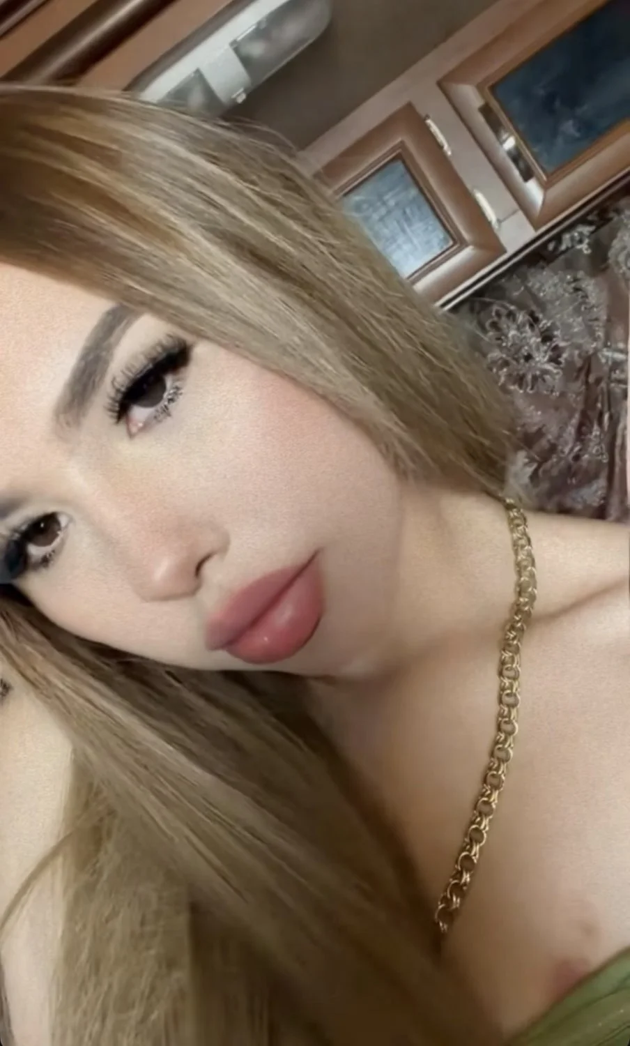 Left baby girl with a hickey on her image 1
