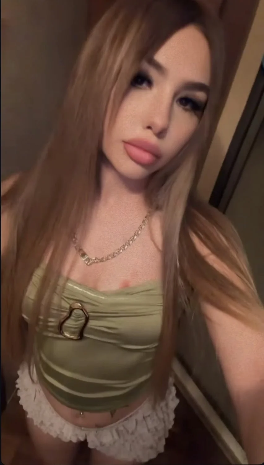 Left baby girl with a hickey on her image 2