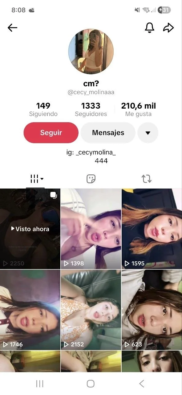Morrita quemada por su ex main image
