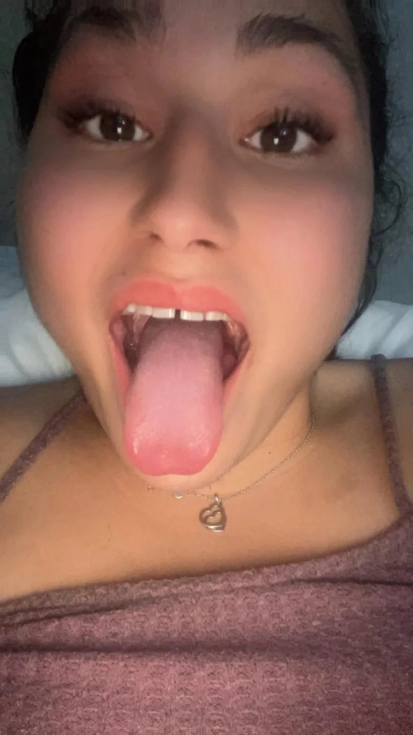 Freaky disabled slut image 7
