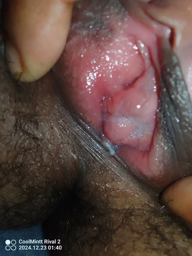 Teen showing her skin🇵🇬 image 12