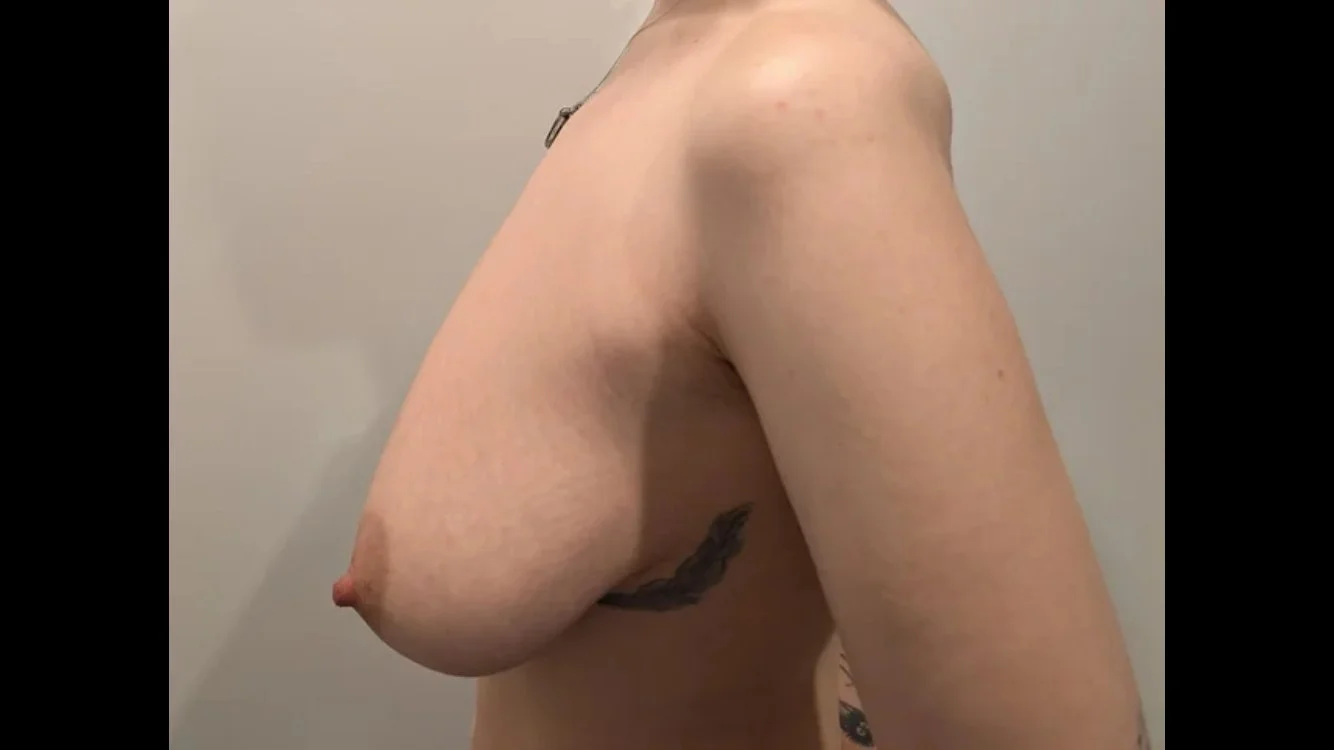 Reddit Reduction Part 11 image 9