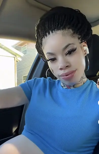 Vitiligo Bihh 🖤🤍 cover image