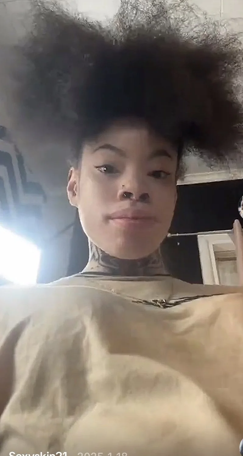 Vitiligo Bihh 🖤🤍 image 2