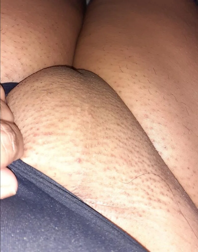 cc main image