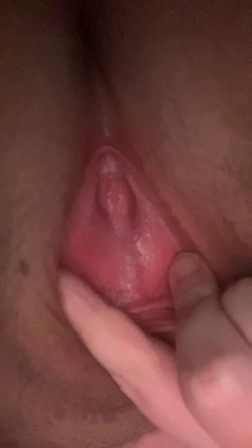 Exposing main image