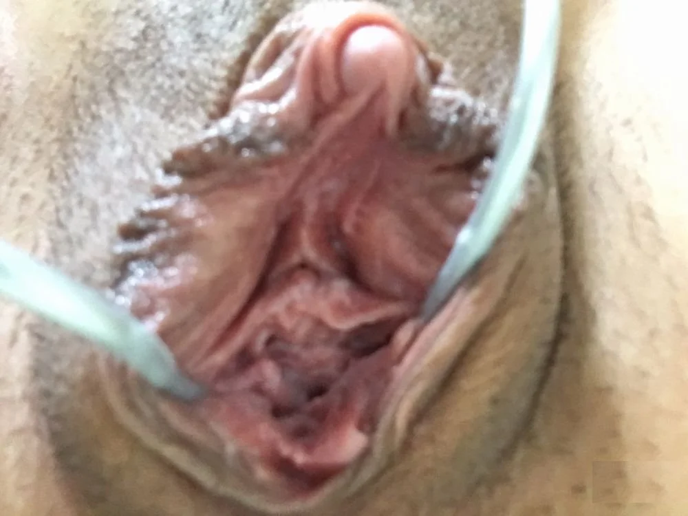 変態雌豚の肥大化したくりちんぽ✌️😁 image 19