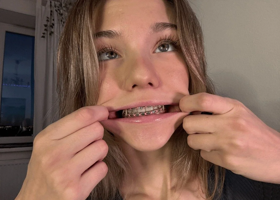 brace face slut image 1