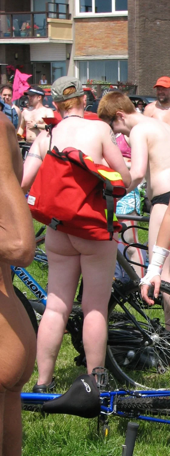 cellulite bums 2 image 15