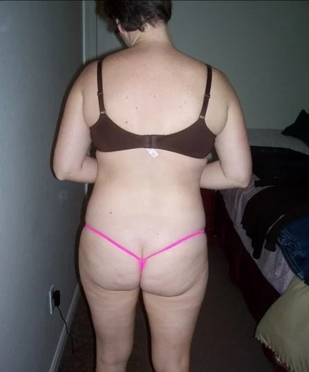 cellulite bums 2 image 2