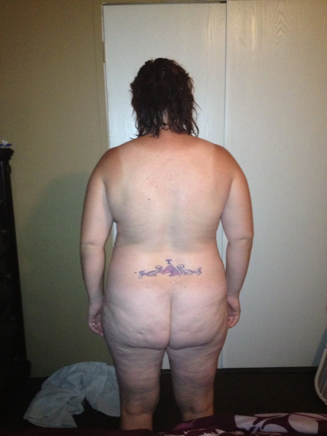 cellulite bums 2 image 33