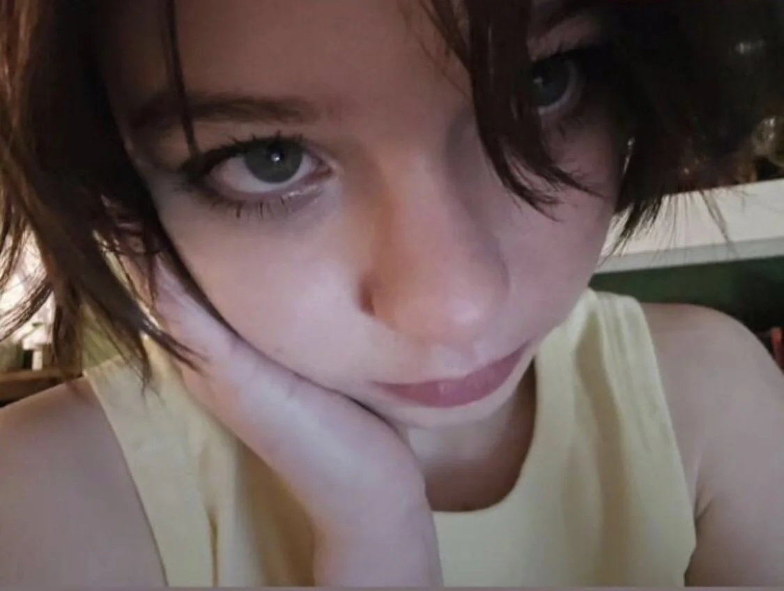 Emma Myers nose (1) image 4