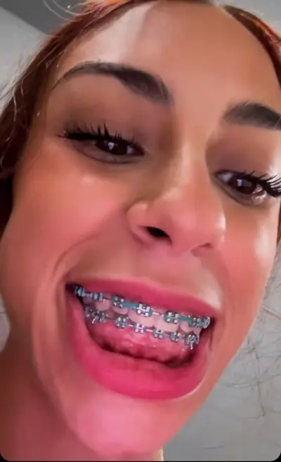 Zorrita con brakets cover image
